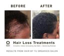 Holistic Hair Growth & Healing Package Online